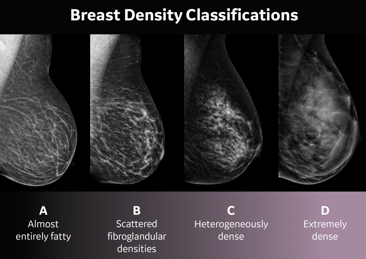 Breast Density In Enid Ok St Marys Regional Medical Center 