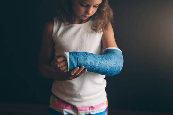 Young child staring pensively at blue cast.