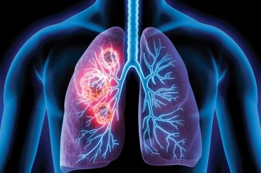 Illustration of shapes in human lungs