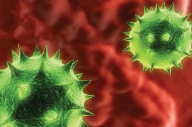 La sepsis es la respuesta extrema del cuerpo a una infección